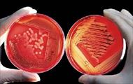دانلود جزوه باکتری شناسی اختصاصی و بیماری های باکتریایی دام پزشکی