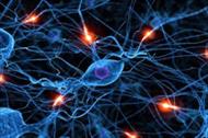 بررسی قدرت پردازش شبکه های عصبی مصنوعی